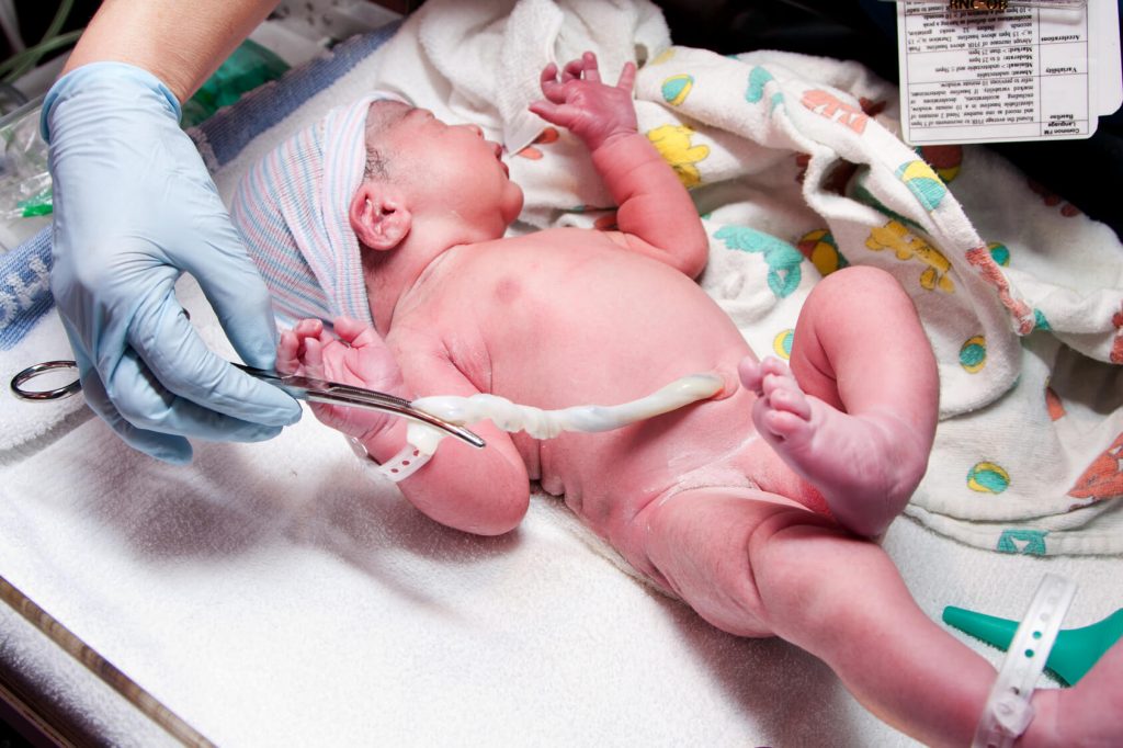 All You Need to Know About Cord Blood